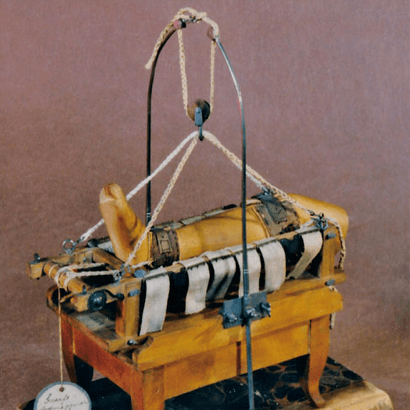 Dette var et viktig unvervisningshjelpemiddel i første halvdel av 1800-årene: En modell av et apparat til bruddbehandling.