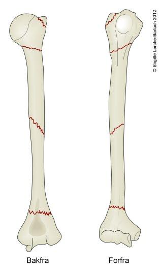 Overarmsbrudd, ulike lokalisasjoner