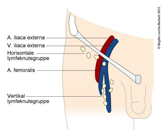 Lymfeknuter i lysken