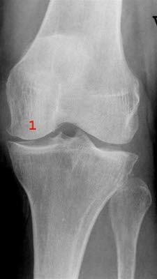 Lette slitasjeforandringer.