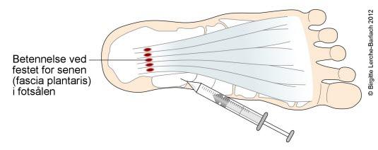 Injeksjonsbehandling
