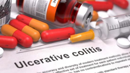 Ulcerøs kolitt