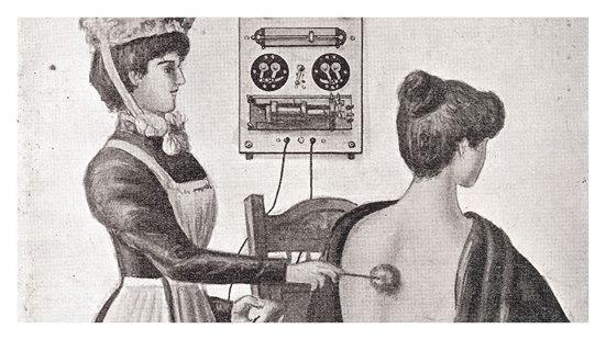 Nevrasteni, elektrobehandling