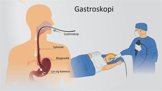 Gastroscopy