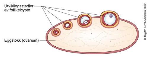 Follikelcyste i eggstokk
