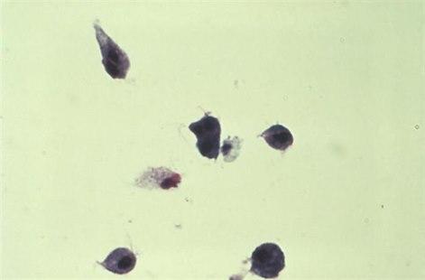 Trichomonas