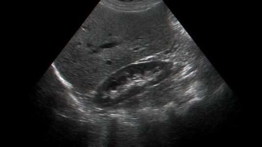 Ultralyd av bukhulen