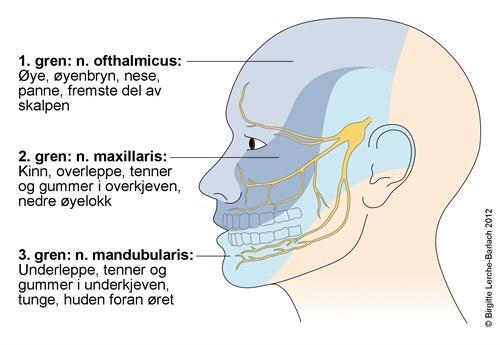 7374-2-trigeminus.jpg 7374-2-trigeminus.jpg