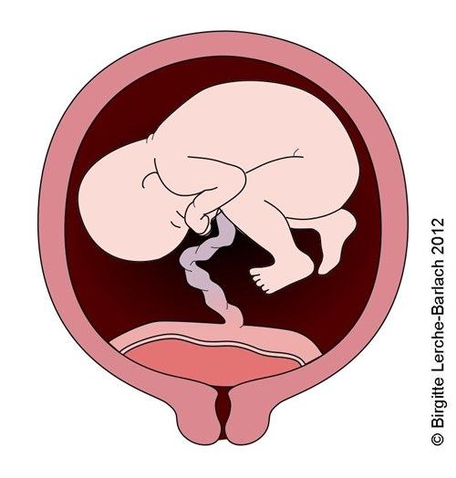 7480-2-placenta-previa-2.jpg 7480-2-placenta-previa-2.jpg
