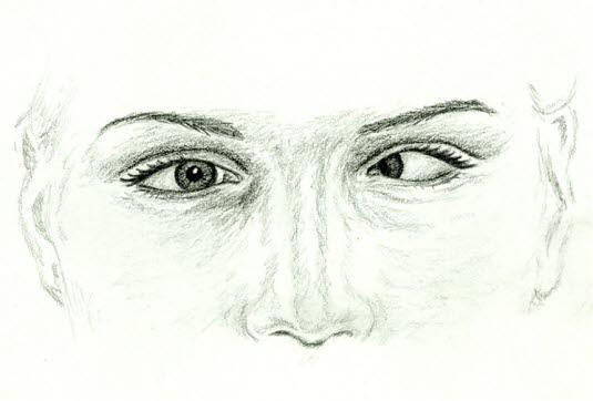 Skjeling venstre øye Skjeling venstre øye