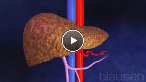 leverbetennelse leverbetennelse