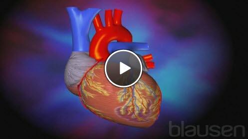 hjerteinfarkt hjerteinfarkt