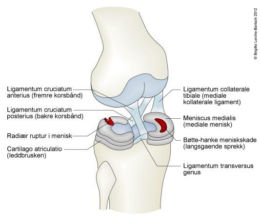 Korsbånd, kne Korsbånd, kne