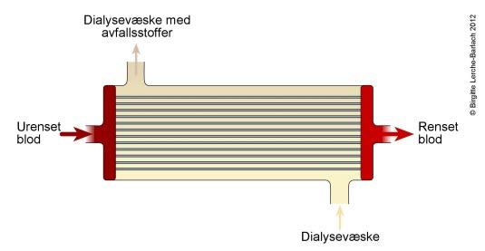 Dialysefilter Dialysefilter