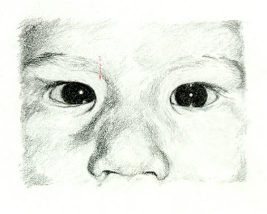 epicantusfold ved blikk rett fram epicantusfold ved blikk rett fram