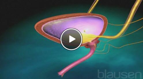 urinlekkasje urinlekkasje