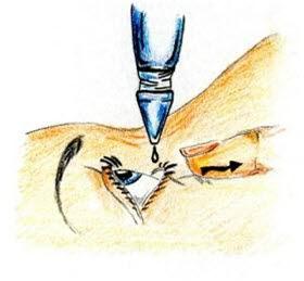 Drypping av øye Drypping av øye