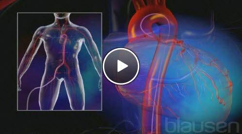 angioplastikk angioplastikk