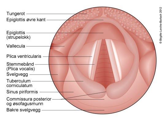 Nedre del av svelget med åpne stemmebånd Nedre del av svelget med åpne stemmebånd