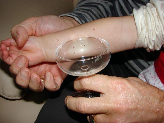 Petekkier, glasstest Petekkier, glasstest