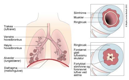 8121-2-id364-trakea-bronkier-alveoler.jpg 8121-2-id364-trakea-bronkier-alveoler.jpg