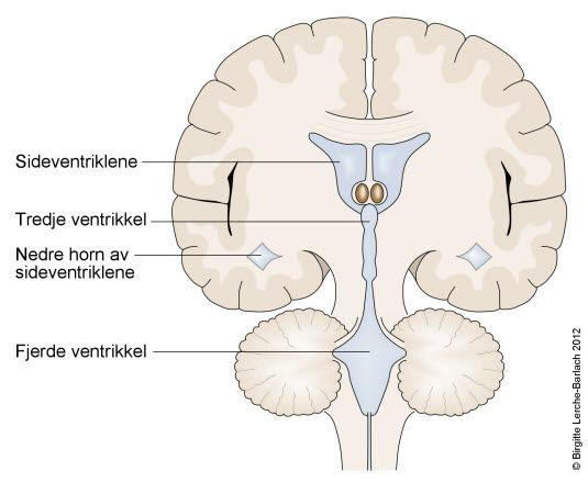 Hjernens ventrikkelsystem, tverrsnitt Hjernens ventrikkelsystem, tverrsnitt