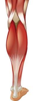 Gastrocnemiusmuskelen i leggen Gastrocnemiusmuskelen i leggen