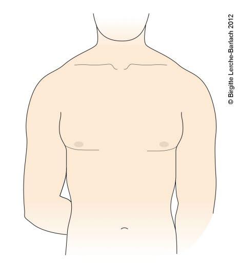 Ved å holde armen i denne stillingen, bak på ryggen med bøy i albuen, blir supraspinatusfestet på overarmsbeinet godt tilgjengelig for injeksjonsbehandling. Ved å holde armen i denne stillingen, bak på ryggen med bøy i albuen, blir supraspinatusfestet på overarmsbeinet godt tilgjengelig for injeksjonsbehandling.