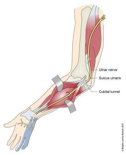 Nervus ulnaris Nervus ulnaris