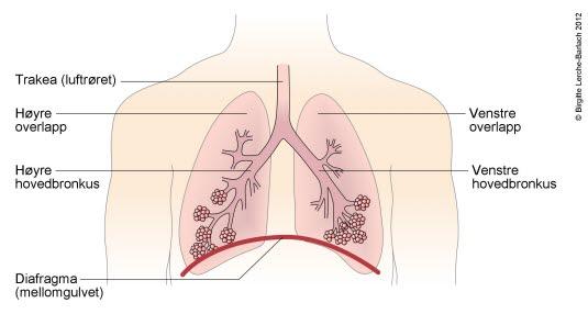 Normalt bronkialtre Normalt bronkialtre