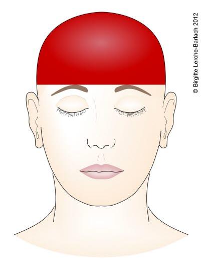 Hodepine - medikamentindusert Hodepine - medikamentindusert