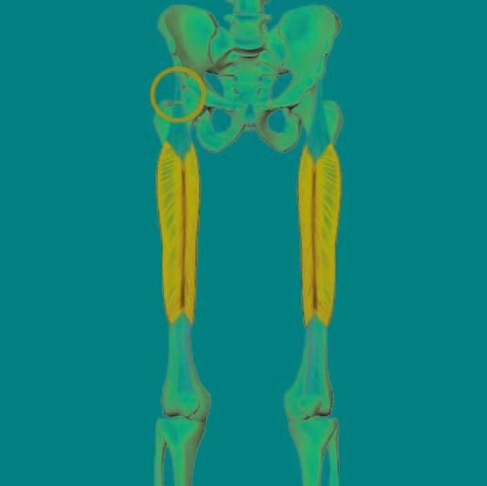 Senebetennelse i den rette lårmuskelen Senebetennelse i den rette lårmuskelen