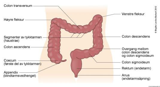 Oversiktsbilde av tykktarmen Oversiktsbilde av tykktarmen