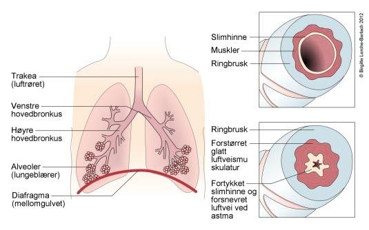 Luftrør, bronkier, alveoler Luftrør, bronkier, alveoler