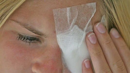 Øyeskade Nærbilde av et ansikt til en dame som har bandasje over et øye