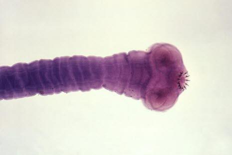 Tape worm, head, microscope