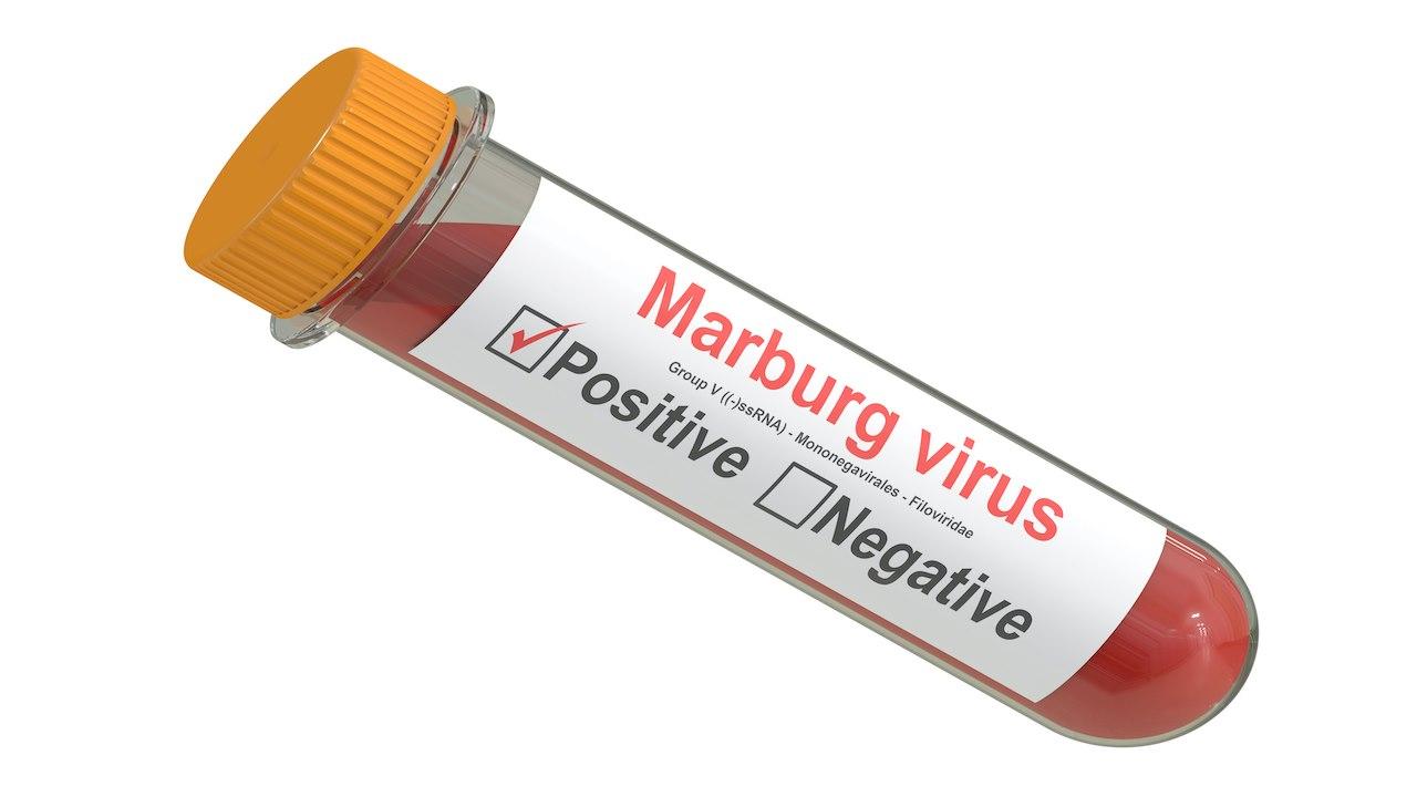 Marburg virusprøve Bilde av prøveglass med blodprøve som viser positiv test på Marburg virus.