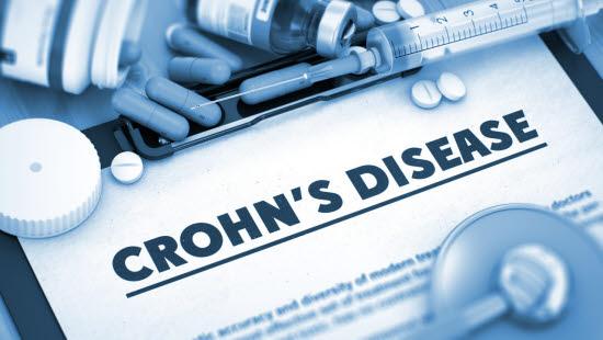 Crohns sykdom