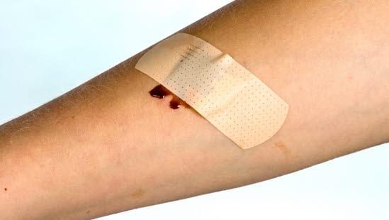 plaster Plastret over et blodig sår