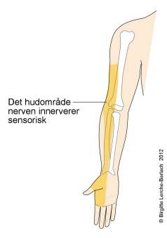 Innervasjonsområdet for nervus radialis