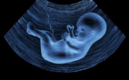 Ultralyd av foster, illustrasjonsbilde