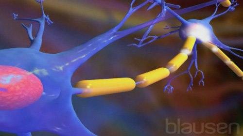 077 Epilepsy Swed 768x432-77