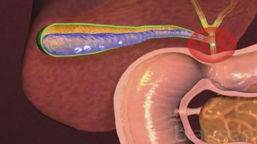 5367-2-gallestein.jpg 5367-2-gallestein.jpg