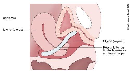 10059-2-id107-pessar-ved-inkontinens.jpg 10059-2-id107-pessar-ved-inkontinens.jpg