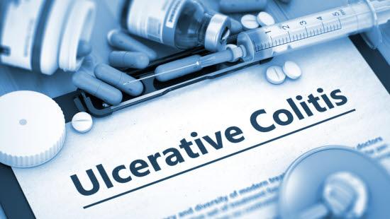 Ulcerøs kolitt