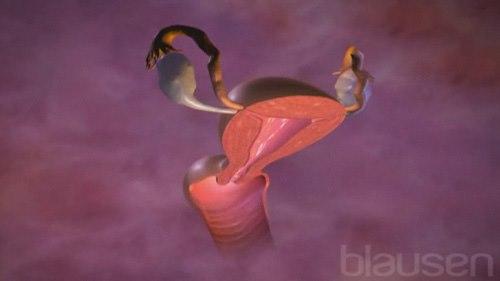 Celleforandringer i livmorhalsen