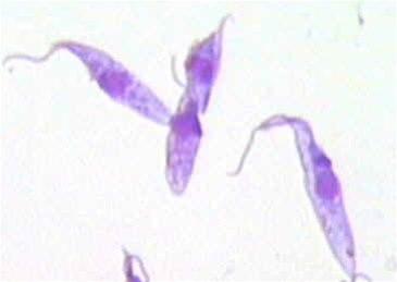 Trypanosoma-cruzi.jpg Trypanosoma-cruzi.jpg