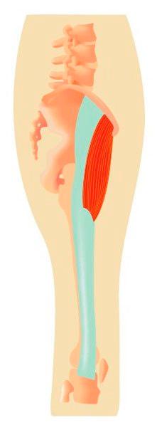 M. tensor fascia latae M. tensor fascia latae