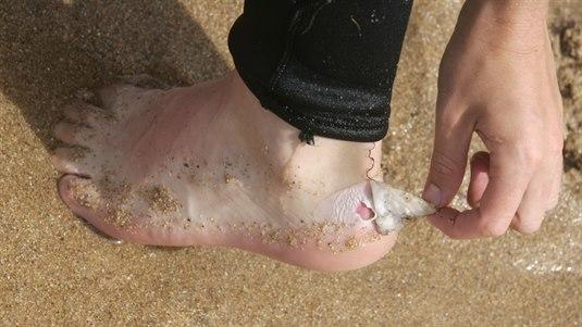 Gnagsår Illustrasjonsfoto av noen som river av et gnagsårplaster som er på hælen. Vi ser en liten del av gnagsåret.