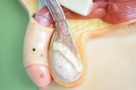 Testikkel med funikkel